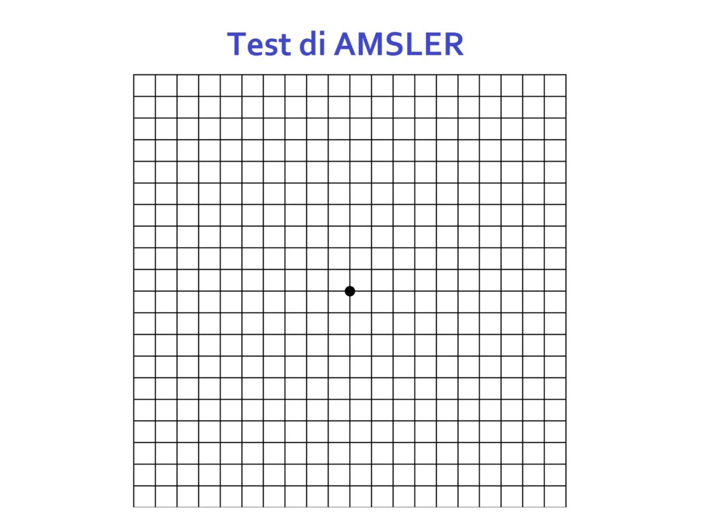 griglia-amsler-copertina